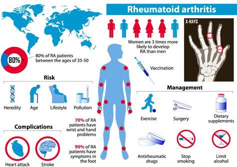 Aug 4, 2023 &0183; Chapter 3 Rheumatoid Arthritis Drug Market Historical (2023-2030) and Forecast (2023-2030) Volume and revenue analysis of Rheumatoid Arthritis Drug Market in North America, Europe, Asia-Pacific. . Arthritis forecast